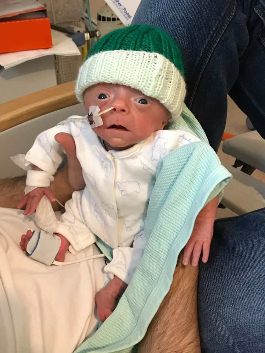 Premature baby being held in a hospital NICU wearing a green knit hat and receiving support through a nasal feeding tube