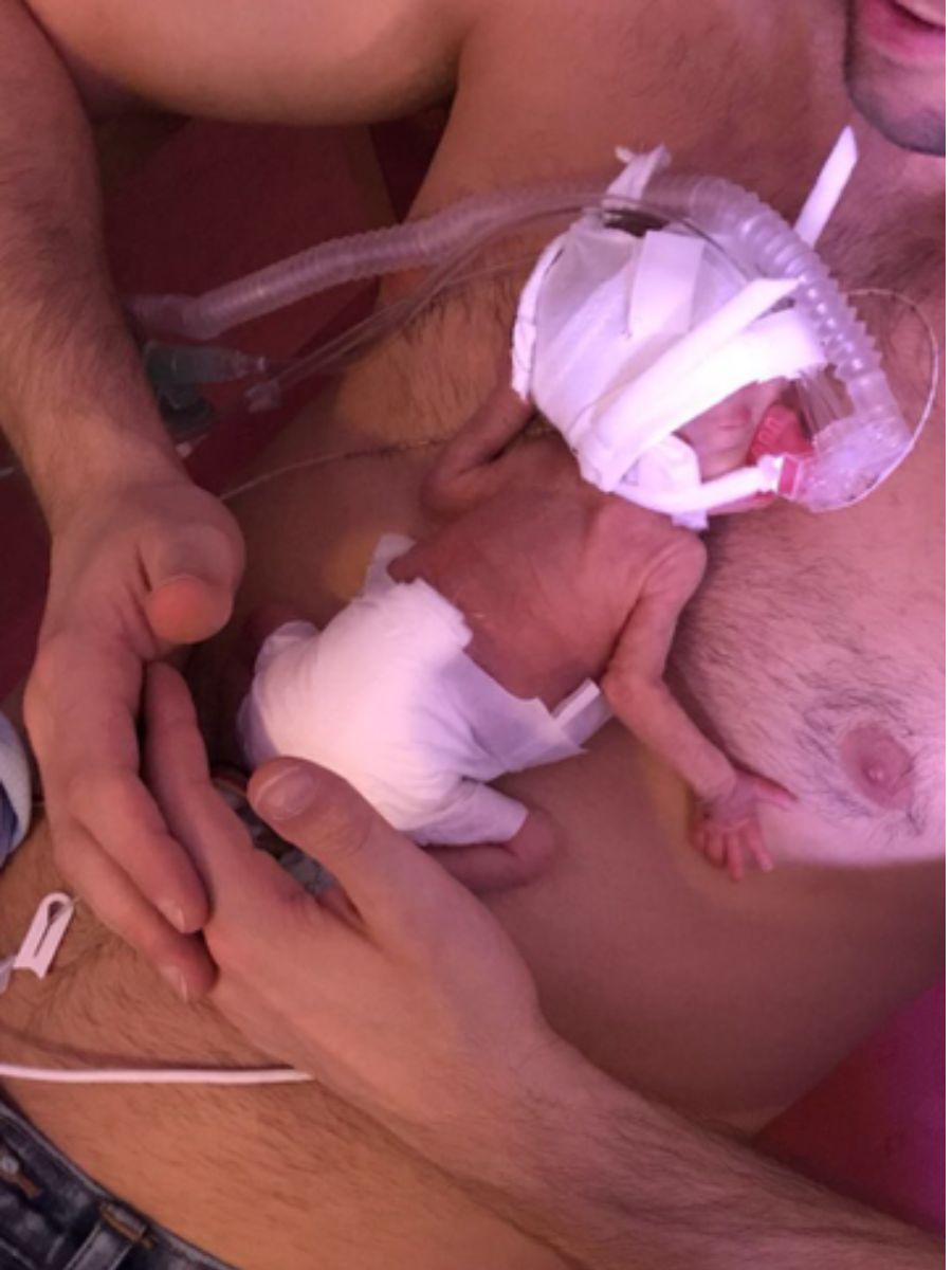 Premature baby in NICU receiving skin-to-skin care with father, connected to medical tubes and monitoring equipment