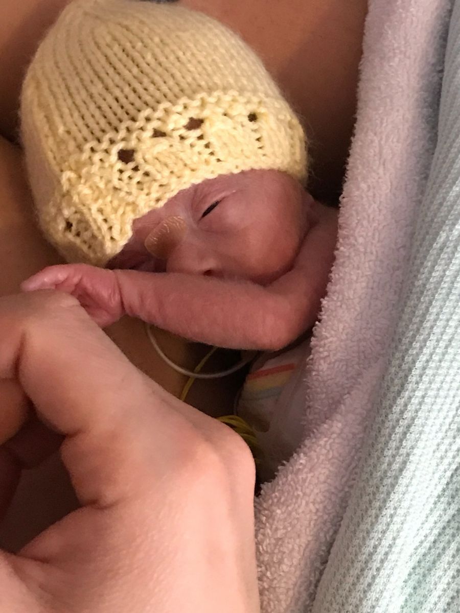 Premature baby wearing a yellow knit hat resting skin-to-skin on a parent’s chest in a NICU setting